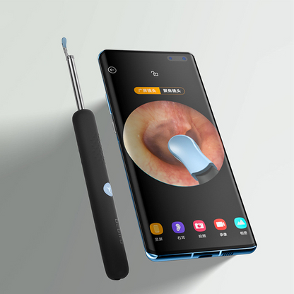 Home Intelligent Visual Ear Picking Tool