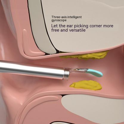 Home Intelligent Visual Ear Picking Tool